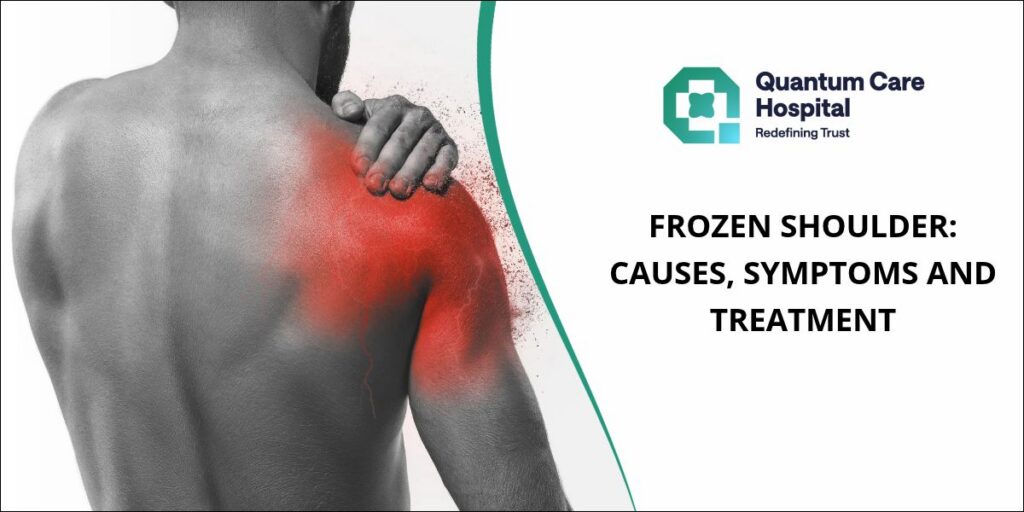 Frozen Shoulder Treatment in Kharadi